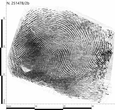 Processed and documented fingerprint (using flip, inversion, crop, lighting, curves, local contrast with added text and scale). image
